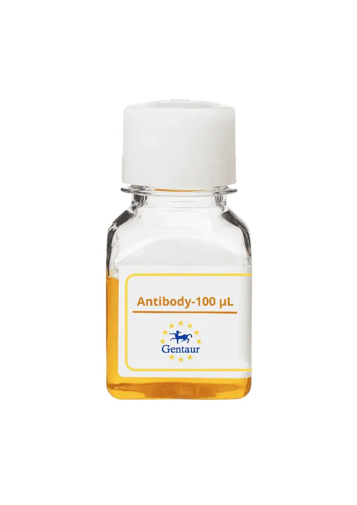 ALKBH5 Antibody   
