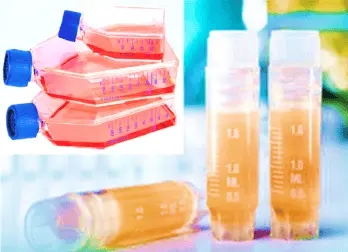 [CELL-SK-761] Human Colonic Fibroblasts